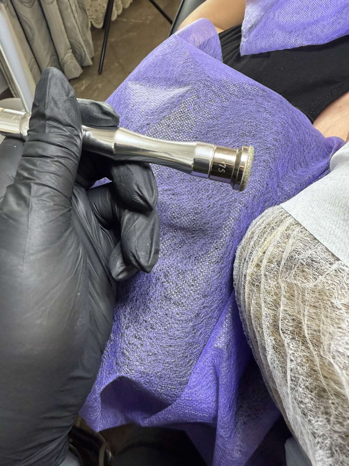 mesotherapia ano liosia theofani antonopoulou