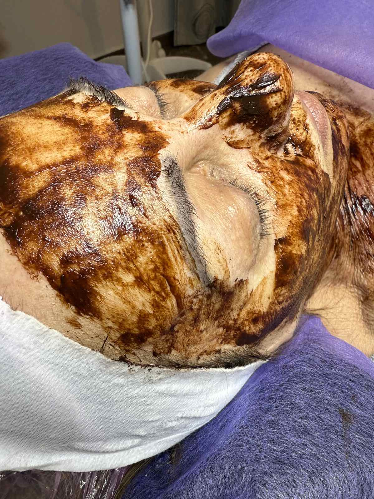 sokolatotherapia ano liosia angel beauty